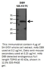 Image for Anti-TDP43 [DB9]