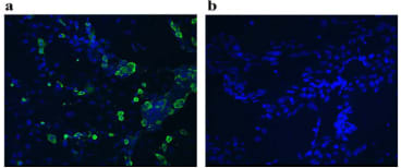 Immunofluorescence staining of cos7 cells transfected with a plasmid containing a full-length CXCL16 open reading frame (a). 48 hours post transfection cells were fixed with 4% paraformaldehyde permeabilised with 0.1% Triton X-100 and stained using Anti-CXCL16 [4.4] and followed by secondary goat anti-mouse FITC (1:100). Nucleic acid DAPI counterstain is shown in blue. A negative control mock is also shown (b).