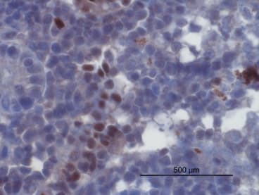 Immunohistochemistry is showing IFN-gamma positive cells using Anti-IFN-γ [VAB3P2D2*C11] in PKD infected rainbow trout kidney. IHC was performed on formalin-fixed, paraffin-embedded tissue sections. Antigen retrieval step is required (antigen retrieval: microwave 20 min @ 800W in 10 mM citrate buffer, pH 6.0).
