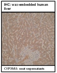 Immunohistochemistry: wax-embedded human liver