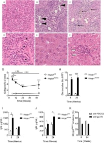 From Kotlinowski J. et al. bioRxiv; 2020. DOI: 10.1101/2020.09.05.250522
Characterization of hallmarks of primary biliary cholangitis in Mcpip1AlbKO mice
HE staining of 52-week old mice showing (A) Proliferation of intrahepatic bile ducts with associated parenchymal inflammation; (B) Epithelial destruction of intrahepatic bile ducts (black arrows) and extensive fibrosis of parenchyma; (C) Resolution of inflammation in intrahepatic bile ducts involving macrophages (black arrows); (D) Dysplasia of cholangiocytes with associated intraductal obstruction of intrahepatic bile ducts (asterisks); (E) Cholestasis and bile acid deposition in hepatocytes; (F) Small granuloma (white arrows indicate hepatocyte necrosis), magnification 400x. (G) Collagen area in the liver of 6, 12, 24, and 52-week-old Mcpip1fl/fl and Mcpip1AlbKO mice; (H) Number of bile ductules in livers per high power field (HPF); Concentrations of total IgG (I) and IgM (J) classes in plasma of 6 and 24-week-old Mcpip1fl/fl and Mcpip1AlbKO mice; (K) Percentage of Mcpip1AlbKO mice, with higher concentration of anti-PDC-E2 antimitochondrial autoantibodies and anti-gp-210 antinuclear autoantibodies compared to mean concentration in control Mcpip1fl/fl counterparts. Data represent mean ± SEM, *p<0.05, ***p < 0.001 vs. Mcpip1 fl/fl; #p < 0.05, ##p < 0.01; ###p < 0.001 vs. 6 weeks. H&E, hematoxylin and eosin. 