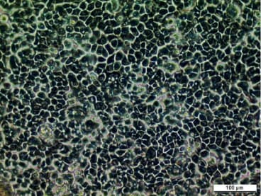 BICR 3 Cell Line. Image courtesy of the European Collection of Authenticated Cell Cultures (ECACC).