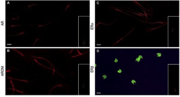 Clone H4 used to detect aromatase in pig sperm by Immunofluorescence. ...B) P450arom red brilliant light in the proximal tail of sperm with a diffuse labelling in the distal tail. Source: Rago et al. 2007. Reprod Biol Endocrinol. 5:23. PMID: 17553131.
