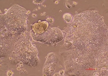 BR98 Cell Line - image captured using a x10 objective lens.