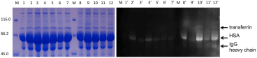 Flu-PAGE analysis of in vitro glycated serum. SDS-PAGE of human serum glycated with 50 mMsugar at 37uC for 7 and 10 days, lanes 2–7 and 8–12 respectively. Shown are non-incubated control (lane 1) and samples incubated with glucose (lanes 2 and 8), fructose (lanes 3 and 9), mannose (lanes 4 and 10), maltose (lanes 5 and 11), galactose (lanes 6 and 12), sucrose (lane 7). The left panel shows Coomassie stained gel (samples 1–12) and the right panel shows the gel visualised with UV prior to staining (lanes 19–129). The arrows indicate fluorescent proteins identified by MS.