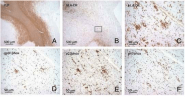 Clone PLPC1 used for the detection of PLP in brain tissue by IHC-P. In the absence of apparent myelin loss (A, E: proteolipid protein) preactive lesions are defined as circumscribed nodules of activated microglia expressing HLA-DR (B, C) and CD68 (D). Source: van Horssen et al. 2012. J Neuroinflammation. 9:156. PMID: 22747960.
