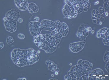 Figure 4. A2780 PTX (128) Cell Line 120 hours after plating. Ready for subculture. Reprinted from Szenajch J. et al. 2020. Int. J. Mol. Sci. 21(23): 9218. 