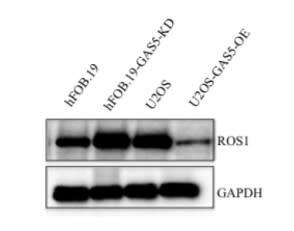 Adapted from Zhang et al. 2019. Int J Biol Sci; 15(7):1460-1471. PMID: 31337976. Figure. Total protein extracts from hFOB1.19 cells expressing control-shRNA (Ctrl) and shGAS5 (GAS5-KD) and U2OS cells expressing pCDNA3 (Ctrl) and pCDNA3-GAS5(GAS5-OE) were applied for Western blot analyses to determine the protein levels of ROS1. GAPDH was used as a loading control.