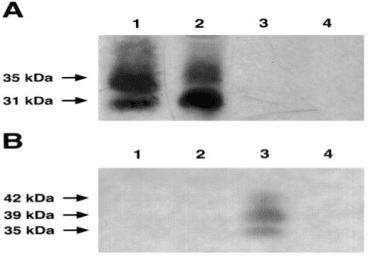 Western Blots showing binding of 17/2 to isoforms of FS288. A. Protein bands corresponding to the approximate 31 and 35K molecular weight isoforms of FS were detected in PC3 media (lane 2) and lanes containing hrFS288 protein. Source: Praticò et al. 2004. Chem Phys Lipids. 128(1-2):165-71. PMID: 15037161. 
