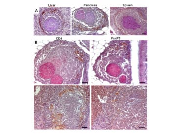 A. CD4+ cells surround  granulomas in the liver, spleen and pancreas of zebrafish infected with Mycobacterium marinum 
B. CD4 and FoxP3 antibodies stain the same areas of both necrotic and solid granulomas in zebrafish infected Mycobacterium marinum 