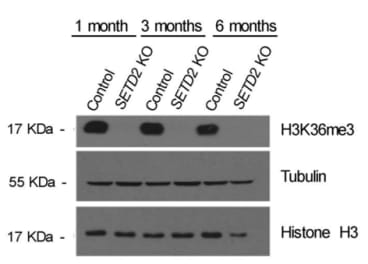 Adapted from Ramos de Matos et al., 2019. Cancers (basel);11(3): 391. PMID: 30897760. Figure 1. CRISPR/Cas9 knockout. The levels of DNMT3A were estimated by western blot 1, 3 and 6 months after CRISPR/Cas9 knockout on Caki-2 cells. 