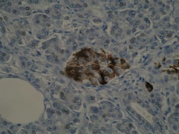 Immunohistochemical analysis of paraffin-embedded human normal pancreas tissue using anti-UCP1 antibody [Vab12 P4B12*A12] showed positive cytoplasmic staining in the Islets of Langerhan. Positive cytoplasmic staining is observed in hibernoma tissue.
