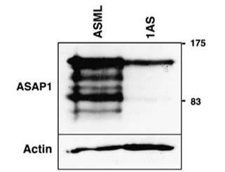 Adapted from Müller et al. 2010. Oncogene; 29(16):2393-403. PMID: 20154719. Figure. Expression of ASAP1 protein in lysates of ASML and 1AS cells. ASAP1 was detected using western blot analysis and the 7B12 antibody. The position of the molecular weight markers is indicated (kDa). The western blot was subsequently stripped and probed with an anti-actin antibody as a loading control.
