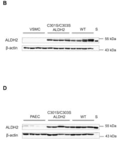 ALDH2 expression in non-infected and infected vascular smooth muscle and porcine aortic endothelial cells. A, expression of ALDH2 in non-infected and infected (WT or C301S/C303S ALDH2) VSMC (n = 4). B, representative Western blot of total homogenates of vascular smooth muscle cells (10 μg of protein), showing ALDH2 (54 kDa) and β-actin (43 kDa). Purified human ALDH2 (25 ng) was used as standard (S) for protein quantification. C, expression of ALDH2 in non-infected and infected (WT or C301S/C303S ALDH2) porcine aortic endothelial cells (PAEC) (n = 5). D, representative Western blot of total homogenates of porcine endothelial cells (10 μg of protein), showing ALDH2 (54 kDa) and β-actin (43 kDa). Purified human ALDH2 (25 ng) was used as standard (S) for protein quantification. Summary data are expressed as ng of ALDH2/μg of total protein and represent mean values ± S.E. of the number of experiments indicated in the panel description above. Adapted Opelt M, Eroglu E, Waldeck-Weiermair M, et al. Formation of Nitric Oxide by Aldehyde Dehydrogenase-2 Is Necessary and Sufficient for Vascular Bioactivation of Nitroglycerin. J Biol Chem. 2016;291(46):24076-24084. doi:10.1074/jbc.M116.752071.