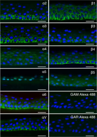 Adapted from Storm RJ, Persson BD, Skalman LN, Frängsmyr L, Lindström M, Rankin G, Lundmark R, Domellöf FP, Arnberg N. Human Adenovirus Type 37 Uses αVβ1 and α3β1 Integrins for Infection of Human Corneal Cells. J Virol. 2017 Feb 14;91(5):e02019-16. doi: 10.1128/JVI.02019-16. PMID: 27974569; PMCID: PMC5309963. Cross sections of human corneas labeled (in green) with antibodies against integrin α2 (P1E6), α3 (ASC-1), α4 (P4C2), α5 (P1D6), α6 (MP4F10), αV (272-17E6), β1 (P5D2), β3 (MHF4), β4 (422325), and β5 (H00051706-D01P), as well as secondary-antibody-only controls GAM Alexa 488 and GAR Alexa 488. Notice the absence of specific labeling of the cell surface with antibodies against integrin α4, α5, and β5. Bar, 25 μm. Nuclei are stained using DAPI (blue). Representative images from 3 cornea explants are shown.