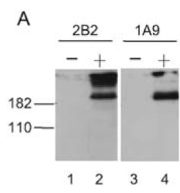 Western blotting on lysates prepared from SARS-CoV-infected Vero E6 cells (+) using anti-SΔ10 [1A9]. A lysate from mock Vero E6 cells is included as a negative control using anti-SΔ10 [1A9].