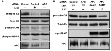 From Valvezan et al. THE JOURNAL OF BIOLOGICAL CHEMISTRY VOL. 287, NO. 6, pp. 3823–3832, February 3, 2012
APC regulates glycogen synthase through GSK-3. 
A, APC was knocked down by siRNA in 293T cells and phosphorylation of GS at an established GSK-3 target site (GS-Ser641) was assessed by immunoblotting with a phosphospecific antibody. The same samples were immunoblotted for total GS (loading control), phospho-Akt (Ser-473), phospho-GSK-3 (Ser-9/21), and APC. Cells in lane 2 were also treated with 15 mM LiCl. Cells were also transfected with a scrambled siRNA (control). APC knockdown reduced APC protein levels and endogenous GS phosphorylation without affecting total GS or phosphorylation of Akt or GSK-3. B, to rescue GS phosphorylation in APC knockdown cells, the Myc-tagged SAMP fragment of APC was co-transfected with scrambled (control) or APC siRNAs. EV indicates empty vector control. The SAMP fragment of APC rescues phosphorylation of GS in APC knockdowns, and this rescue is blocked by LiCl.