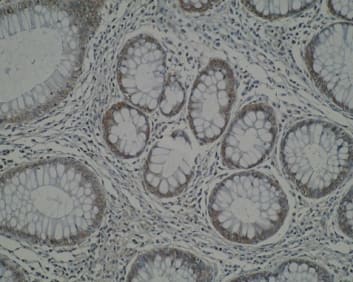 IHC photomicrographs showing weak cytoplasmic staining of Anti-CIDE A [V62P1E3*B10] in normal colon mucosa.  IHC was performed on formalin-fixed, paraffin-embedded normal colon mucosa.

