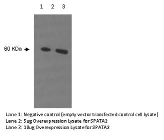 Western blot analysis using Anti-Spermatogenesis Associated 2 [Z1P1F10*F12].