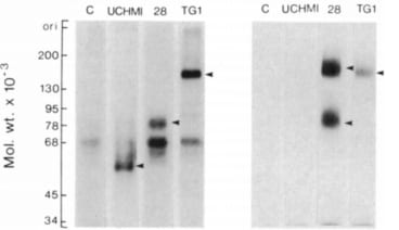 Adapted from Hogg et al. 1984. Immunology. 53(4):753-67. PMID: 6389324. Figure. Monoclonal antibody immunoprecipitates from 125I-labelled monocyte and granulocyte lysates identified by 7.5% SDS-polyacrylamide gel electrophoresis after sample reduction. Positive reactions are indicated by arrows. Control preparations were incubated with mAb 5-5. Molecular weight markers were myosin, 200,000; fi-galactosidase, 130,000; phosphorylase b, 95,000; transferrin, 78,000; bovine albumin, 68,000; ovalbumin 45,000; glyceraldehyde 3-phosphate dehydrogenase 34,000; light chain, 25,000 cytochrome c, 12,500.
