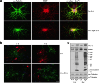 Clone 12 used to detect MBP in mouse oligodendrocytes using Immunofluorescence and Western Blot. α-Syn impairs oligodendrocyte maturation. Oligodendrocyte progenitor cells were either untreated (Co) or incubated with rh α-Syn (10 μg/ml) 2 h after plating for 3 or 6 days. Cells were subjected to immunocytochemistry using antibodies: a anti-acetylated α-tubulin (green) and anti-MBP (red); b anti-proteoglycan NG-2 (green) and anti-MBP (red). Nuclei were stained with DAPI (blue). Scale bar: 20 μm. c Exogenously applied α-Syn led to an increase in NG-2 and a decrease in MBP levels. Source: Grigoletto et al. 2017. Acta Neuropathol Commun. 5(1):37. PMID: 28482862.
