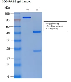 SDS-PAGE gel of Anti-Estradiol-17-beta [S16] recombinant antibody in both its reduced and non-reduced state. 