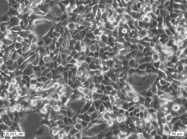 2fTGH Cell Line. Image courtesy of the European Collection of Authenticated Cell Cultures (ECACC)