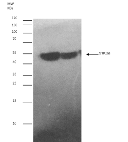 Western blot of colon tumour tissue lysates probed with Anti-hnRNP-K (isoform1) [N10 P2D3*G2]
