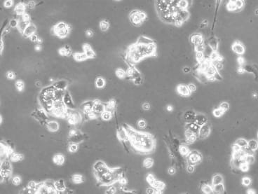 BICR 18 Cell Line. 24 hours post plating. Image courtesy of the European Collection of Authenticated Cell Cultures (ECACC).