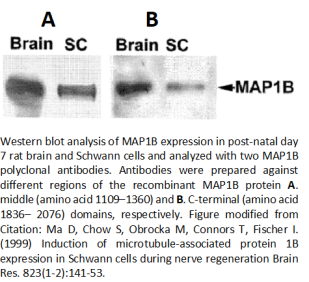 anti map1b polyclonal antibodies polyclonal antibodies polyclonal antibodies