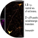 Immunohistochemistry staining using anti-Phospho Tyrosine Hydroxylase (Ser40) [AV4]