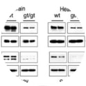 Adapted from Debrand et al. 2009. FEBS J. 276(6):1610-28. PMID: 19220457. Figure. Proteins from wild-type (wt) and homozygous gene trap (gt/gt) mice were analysed by western blotting. Equal amount of total proteins were loaded, and talin 2 was detected with a monoclonal antibody against talin 2 (epitope within residues 482–991). Vinculin was used as an additional loading control.