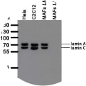 Western blot analysis of LASS2D9 antibody. Whole cell lysate from human (Hela) and mouse (C2C12, mouse adult fibroblasts (MAFs)) cell lines cells were separated on SDS-PAGE gel, transferred to nitrocellulose membrane and blotted with LASS2D9 antibody. The membrane was blocked overnight in blocking buffer (5% nonfat dry milk resuspended in 0.1% Tween and 1X PBS). Both primary and secondary antibodies were diluted in blocking buffer. The predicted molecular weight for lamin A is 74 kDA and for lamin C 65 kDa. The absence of a band in LMNA null MAFs indicated that the antibody specifically recognizes products of LMNA gene.