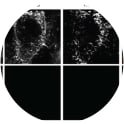 Adapted from Vanover et al. 2017. Nat Commun. 8(1):667. PMID: 28939853. Figure. Vero cells infected (top) or mock-infected (bottom) for 24 h with RSV A2 at an MOI of 1 were labeled with SBA-488 at 4 °C (green) before being fixed and stained for RSV G (red), RSV F (blue), and nuclei (gray)