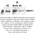 Image for Anti-MAP1B, Polyclonal antibodies