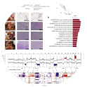 Figure 1.  
Characterization of Murine HGSOC Models

(A) Overview of murine models and the analyses conducted.

(B) Left panel: gross anatomy of the tumor distribution in the peritoneal cavity of a mouse injected with the HGS2 cell line and culled at a humane endpoint. Omental (O), mesenteric (M), and splenoportal (SP) tumor deposits are highlighted with a dashed line. A metastasis to the liver surface is indicated by an arrow. Center and right panels: tissue sections were derived from normal omenta (Bl6Ome and FVBOme) and mouse model tumors (60577, 30200, HGS1, HGS2, HGS3, and GEMM) and stained with hematoxylin and eosin (scale bars, 100 μm).

(C) Unsupervised clustering of RNA-seq sample groups by principal-component analysis.

(D) Significantly enriched Gene Ontology (GO) terms and pathways (p < 0.001) in the common 1,292 differentially expressed genes.

(E) Genomic alterations found in murine HGSOC. Copy number losses and gains are shown in blue and red, respectively. Key orthologous genes, frequently altered in human HGSOC, are indicated with blue for losses and red for gains.

(F) OncoPrint showing genes with high mutation frequency in TCGA and present in CNA regions in mouse models.
