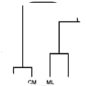 Dendrogram of cluster analysis of microarrays. CL, normal male murine lung – Control for the D122 Lewis lung model; CM, normal female murine lung – control for the B16-F10.9 melanoma model; ML – pulmonary metastases of the D122 Lewis lung model; PL – primary tumour of the D122 Lewis lung model; MM – pulmonary metastases of the B16-F10.9 melanoma model; PM – primary tumour of the B 16-F10.9 melanoma model.