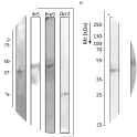 Figure 4. Western blot of Candida albicans proteins. A) Recombinant proteins obtained in Escherichia coli model. B) Comparison of the Kre9 recombinant protein obtained in Escherichia coli with that obtained in Pichia pastoris.