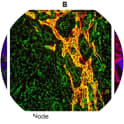 Immunofluorescence on tissues. A: Mouse lung. Positive staining for EMILIN-1 (green) is both detected in lung parenchymal fibers and associated with lymphatic vessel structures. Lyve-1 (red) is used as lymphatic vessel marker. Blue, nuclei. Scale bar: 37.00 µm. B: Mouse lymph node. In green, positive staining for EMILIN-1; in red, lymphatic vessels positive for Lyve- 1. Yellow represents the close association of EMILIN1 with lymphatic vessel structures. Scale bar: 37.00 µm. C: Mouse skin. In red, positive staining for EMILIN-1. Blue, nuclei . Scale bar: 37.00 µm.
