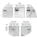 Adapted from Heng S, Dynon K, Li Y, Edgell T, Walton K, Rombauts LJ, Vollenhoven B, Nie G. Development of a high-throughput assay for human proprotein convertase 5/6 for detecting uterine receptivity. Anal Biochem. 2015 Apr 15;475:14-21. doi: 10.1016/j.ab.2014.12.012. Epub 2014 Dec 30. PMID: 25554488.Western blots confirming that all three PC6 mAbs (9H12, 8F5 and 4H11) detect PC6 but not PC members PC7 or furin. Blots were also probed with anti-PC7 and anti-furin antibodies to confirm the integrity of PC7 and furin proteins. 
