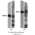 The antigen present in all lanes was gradient purified RSN-A2 virus (subgroup A). First antibodies: lanes “mAb”: 11-2-F3 antibody; lanes “Hus”: RS virus convalescent human sera. Panel A: Antigen analysed by electrophoresis using reducing conditions (SDS and mercapthoethanol). Panel B: Antigen analysed by electrophoresis using non reducing conditions (SDS only) (Gimenez et al., 1986).

The identity and molecular weight of the protein target of this antibody was validated by including within the immunoblot assay (as a marker) a convalescent serum sample from a RS virus infected patient. The protein specificities of the antibodies induced in the human convalescent serum is described in Gimenez et al. (1987).
