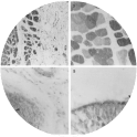 Fig. 2 Myocardium of the human left ventricle, strongly reactive with anti-human H-FABP antiserum. Note immunonegativity of the subendocardial connective tissue and the smaller blood vessels, x110
Fig. 3 Human striated muscle of the M. dorsalis longus, demonstrating different reactivity of white and red muscle fibres with anti-human H-FABP antiserum, x110
Fig. 4 Large artery of the human perigenital fat tissue showing faint H-FABP expression (arrowhead) with anti-human H-FABP antiserum (L Lumen). x220
Fig. 5 Epithelial layer of a large bronchus of the human lung. Distinct immunoreactivity of the apical cell compartments with antihuman H-FABP antiserum (arrowhead). x550 