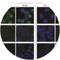 Detection of endogenous c-Met in SNU-5 (c-Met positive) and T47D (c-Met negative) cells by immunofluorescence using purified anti-alpha-chain monoclonal antibodies. 