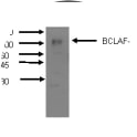 Western Blot using mAb M33-P5B11