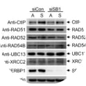 Adapted from Ahn et al. 2015. Nucleic Acids Res. 43(13):6321-33. PMID: 26068472. Figure. U2OS cells were either not treated or synchronized at the S phase by aphidicolin treatment. The synchronized cells were left undepleted or depleted of SERBP1. Cell lysates were subjected to immunoblotting using the indicated antibodies. 