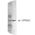 Image for Anti-RSV Nucleoprotein VP41 [4-18]