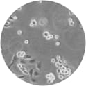 SVCT-MI2 Cell Line. 24 hours post plating. Image courtesy of the European Collection of Authenticated Cell Cultures (ECACC)