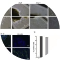 Isolation and characterization of vulva cancer cells (VCC1). Representative phase contrast images showing outgrowth of cancer cells at day 4 (a), day 6 (b) and day 9 (c) respectively. Morphology of VCC1 is mainly polygonal (d). Scale bar- 50 μm. Image modified from https://doi.org/10.1016/j.yexcr.2019.111684.