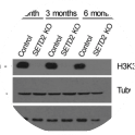 Adapted from Ramos de Matos et al., 2019. Cancers (basel);11(3): 391. PMID: 30897760. Figure 1. CRISPR/Cas9 knockout. The levels of DNMT3A were estimated by western blot 1, 3 and 6 months after CRISPR/Cas9 knockout on Caki-2 cells. 