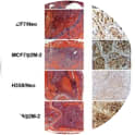 Adapted from Josson et al. 2011. Cancer Res. 71(7):2600-10. PMID: 21427356. Figure A, histomorphology (left) and immunohistochemical staining of β2-M (right) in metastatic bone induced by intracardiac injections of ARCaP subclones and Neo and β2-M overexpressing clones of MCF7, H358, and SN12C in nude mice.